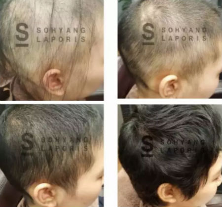 唯拾壹|別人脫單你脫發(fā)？樣的頭皮管理能讓你分分鐘開掛！