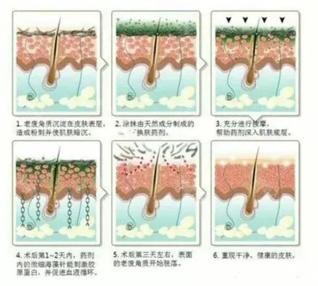 堪稱“換臉”的神奇煥膚術，你get了嗎？