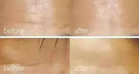 還在靠敷面膜補水？那你的皮膚肯定出問題！