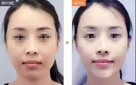 還在靠敷面膜補水？那你的皮膚肯定出問題！