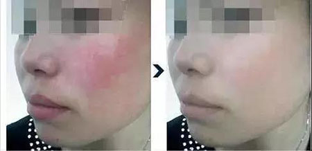 還在靠敷面膜補水？那你的皮膚肯定出問題！