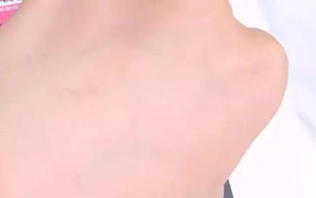 敏感肌不能化妝？良心推薦這款修復(fù)遮瑕霜！