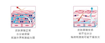 “皮膚屏障受損”如何自查?