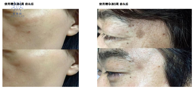 美業掘金內幕｜院線護理“爆品打造”六要素