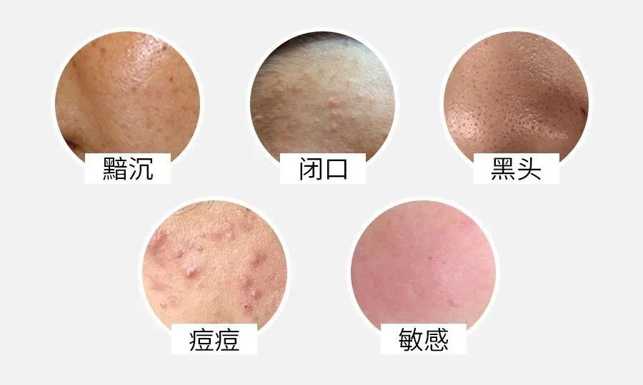 唯美度潔顏乳 | 調膚絕佳搭檔,洗出嫩滑牛奶肌