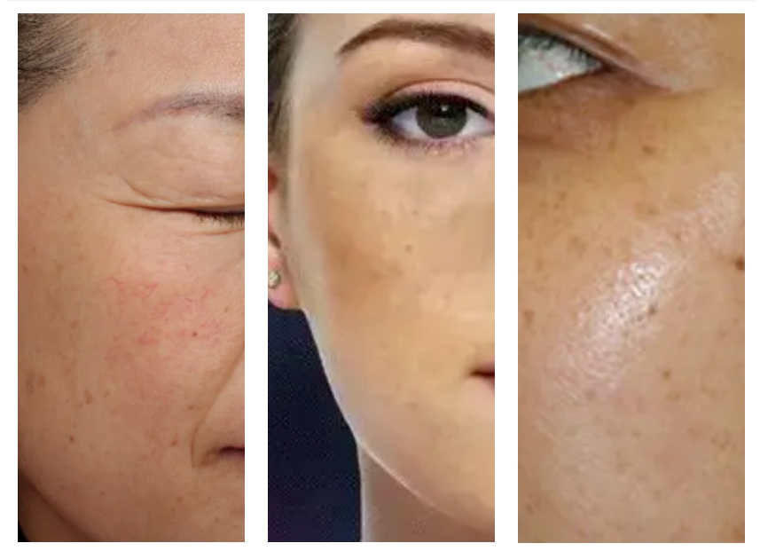 燕麥多糖抗皺乳液 | 抵御衰老侵襲，向時(shí)光開戰(zhàn)