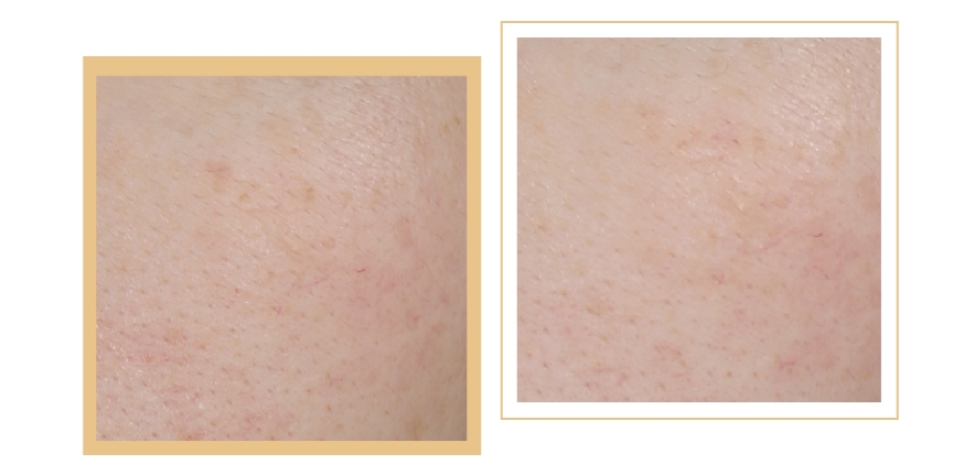 燕麥多糖抗皺乳液 | 抵御衰老侵襲，向時(shí)光開戰(zhàn)