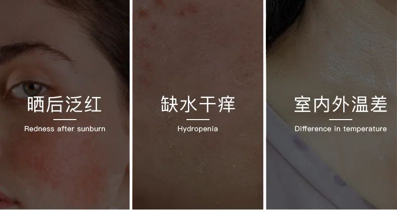 無懼時光，天生優(yōu)雅，敏感肌&受損肌的修護“膜”法